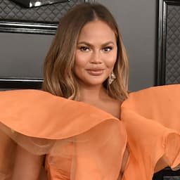 Chrissy Teigen Says Her Tongue Is 'Falling Off' From Sour Candy