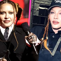 Madonna Pokes Fun at Her Face Following ‘Surgery’ 