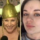 Golden Globes 2020: Patricia Arquette On How Joey King Got a Giant Welt on Her Forehead (Exclusive)
