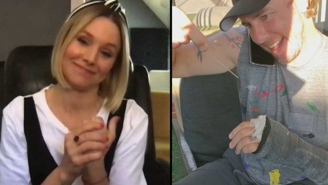 Dax Shepard Shattered His Hand and Was Afraid to Tell Kristen Bell