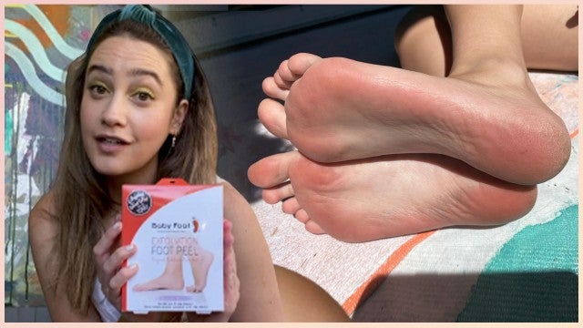 ET Style Tried the Cult-Favorite Baby Foot Peel
