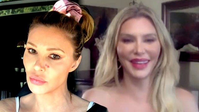 Brandi Glanville Fires Back at Comments on Her Looks, Talks Battle With Psoriasis (Exclusive)