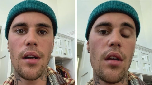 Justin Bieber Diagnosed With Rare Face Paralysis Diagnosis