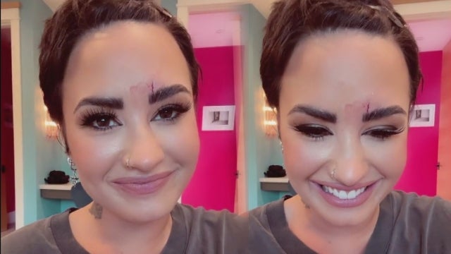 Demi Lovato Reveals Gnarly Face Injury That Requires Stitches