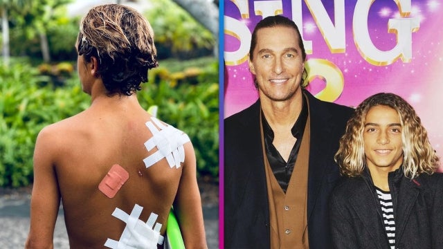 Matthew McConaughey offers a rare look at his son, Levi. The actor took to Instagram on Thursday to show off the bandages on the 14-year-old’s back, which he calls ‘surf souvenirs.’ Matthew and his wife, Camila Alves, also share a 10-year-old son, Livingston, and 13-year-old daughter, Vida.