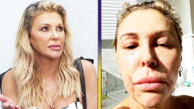 Brandi Glanville Opens Up About ‘Stress-Induced’ Health Issues After ‘RHUGT’ Drama (Exclusive)
