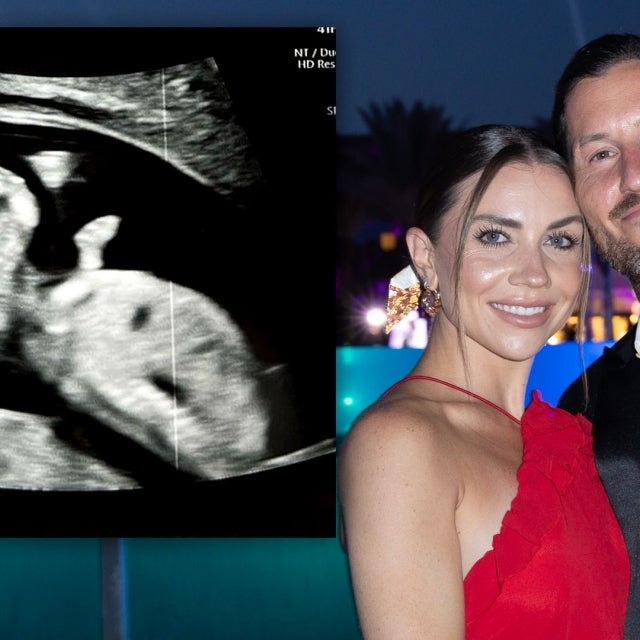 Val Chmerkovskiy and Jenna Johnson Are Expecting Their First Child